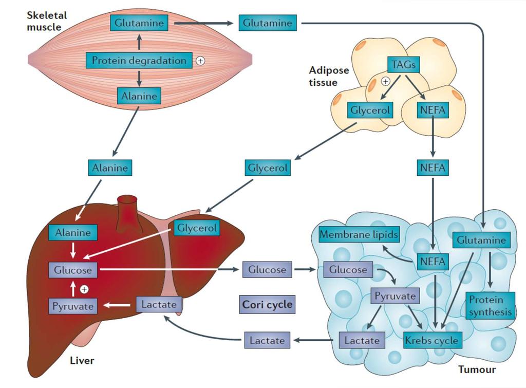 Cancer Cachexia Pathophysiology Important flow of amino acids from skeletal muscle to