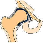 Classification of Joints 1.
