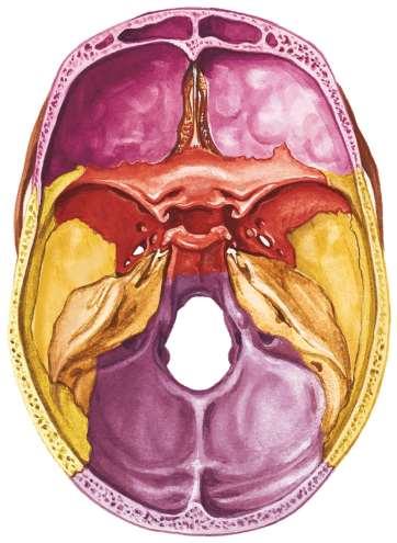 Interior of the Cranial Cavity Frontal sinuses Anterior cranial fossa Crista galli Olfactory foramina Cribriform plate Frontal bone Ethmoid bone Sphenoid bone Temporal bone Lesser wing Greater wing
