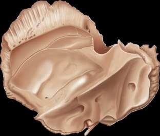 11) Depression in the floor of the cranial cavity formed by the temporall obesof the brain Petrous portion (shown in