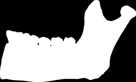 Premolars Canine Body Condylar Coronoid Mandibular condyle Mandibular foramen Mandibular notch Mental foramen Mylohyoid line Oblique line