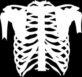rib Functions Protects vital organs Forms semi-rigid chamber for respiration Parts Thoracic vertebrae Ribs (12 pair) True or Vertebrosternal: superior seven.