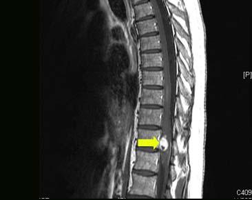 Patient CR T1 Axial and