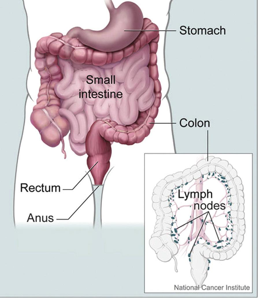 Colorectal Cancer AN INTRODUCTION (figure 1) Identifying the Colon and the Rectum What is cancer?