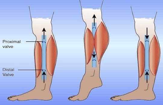 Materials: Bandage Stiffness Remains rigid as calf muscle contracts Generates