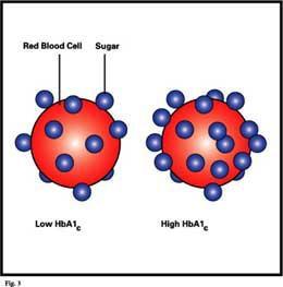 Increased blood glucose and hemoglobin: formation of glycosylated hemoglobin