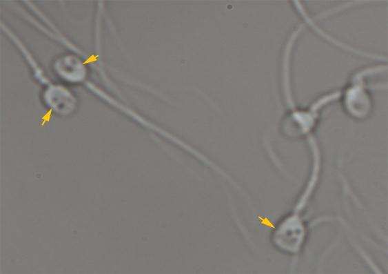 Ghazali et al Figure 2. Spermatozoa at high magnification (6600 ). The arrows the spermatozoa with mix vacuoles (having more than two vacuoles). Figure 3. Spermatozoa at high magnification (6600 ).a and b: spermatozoa with cytoplasmic droplet, c: spermatozoa having no cytoplasmic droplet.