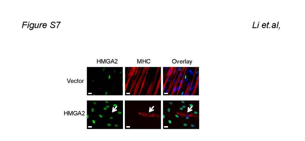 Figure S7: Overexpression of HMGA2 blocks terminal muscle differentiation Human myoblasts were infected by lentiviral based HMGA2 overexpression or vector only constructs for 48 hours and switched to
