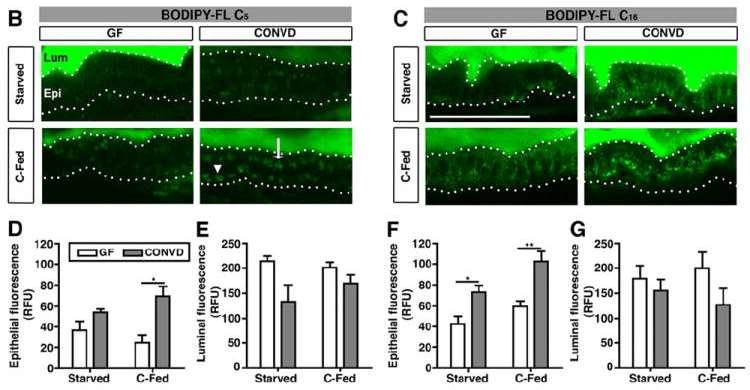 212 Cell Host & Microbe mice are resistant to diet-induced obesity Fat Digestion and Absorption is Regulated on