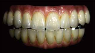 Absolute Dental Lab Established in 1994, Absolute Dental started as a fixed prosthetics lab in the Triangle area of