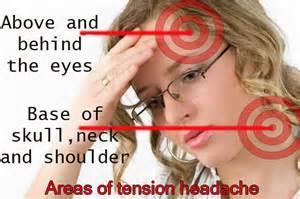 Tension Headache Signs and symptoms of a tension headache include: Dull, aching head pain Sensation of tightness or pressure across your forehead or on the sides and back