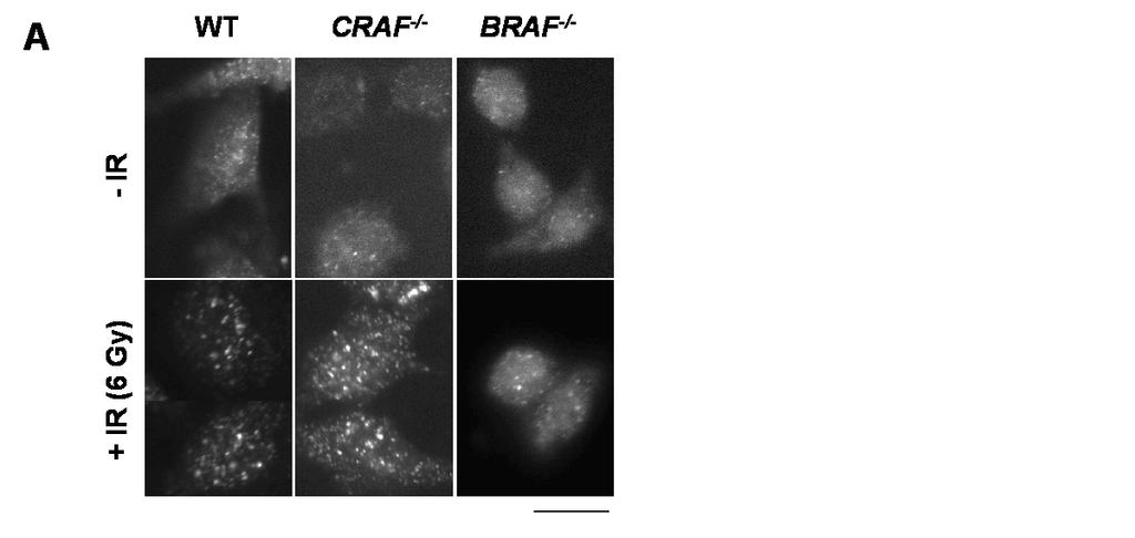 Supplementary Figure 1: si-craf but not si-braf sensitizes tumor cells to radiation.