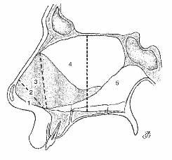Appendix 1: Cottle s areas - as demonstrated in Huizing (2003) 51 Area 1: Area 2: Area 3: Area 4: Area 5: Nostril Nasal valve Area underneath the bony and cartilaginous vault (also