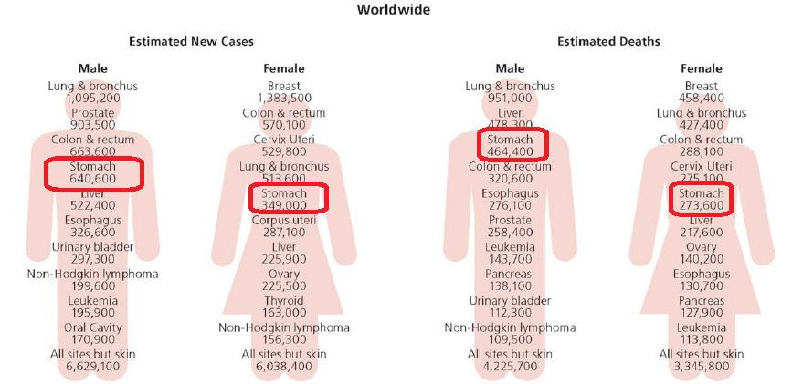 Gastric Cancer --High Global Burden Global Cancer Deaths % of all cancer (2008) deaths Lung Cancer 1,400,000 18.