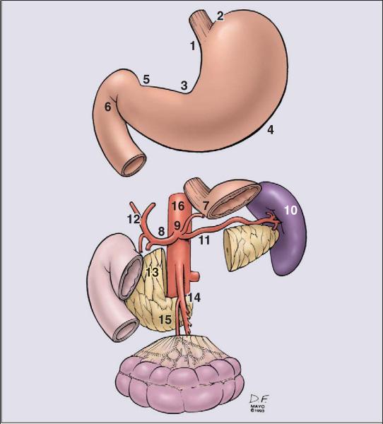 Curative Surgery is mainstay of care in Gastric Cancer (GC) D2 Gastrectomy is a standard of care here European studies have not shown better outcomes with D2 vs D1 dissection and have higher postop
