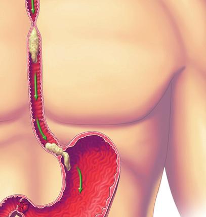How does this happen? The esophagus expands and contracts to push the bolus down to the stomach.