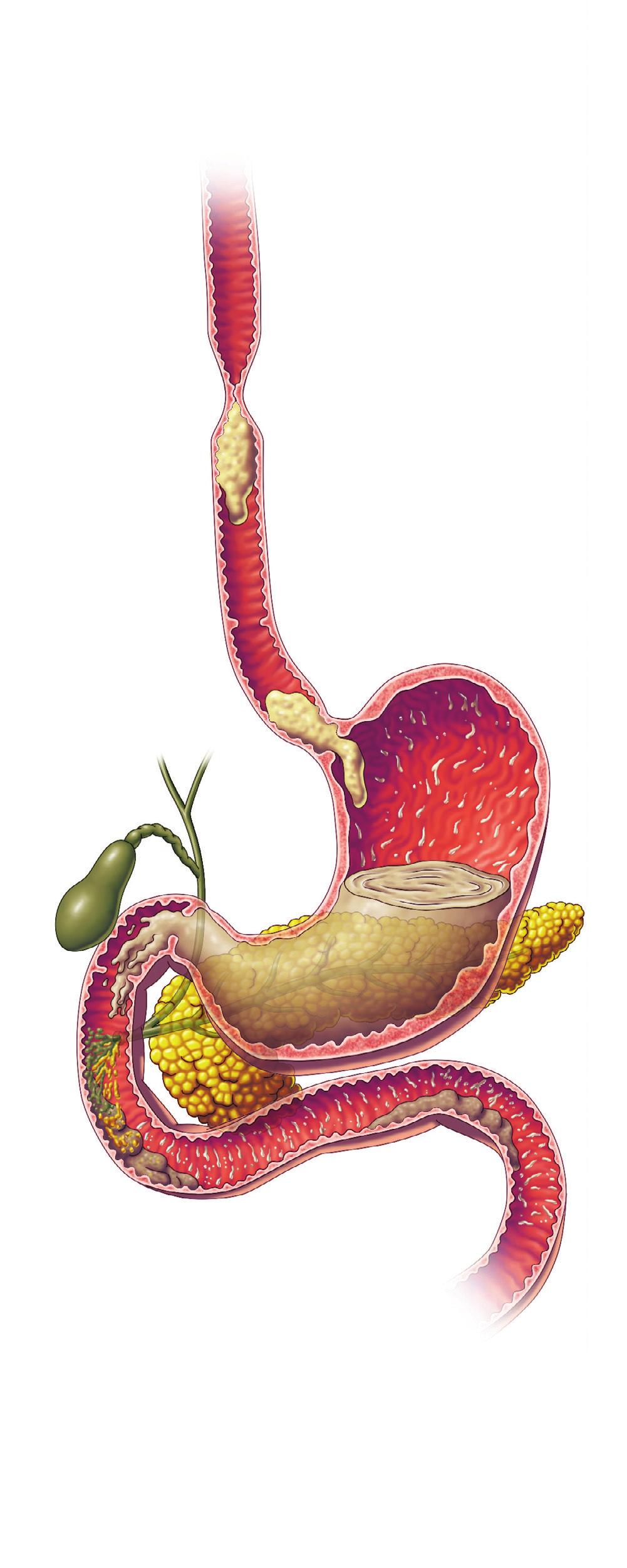 Section 2 / The Digestive System Connecting Digestion in the Stomach: The Process Continues Does your stomach ever make noises after you eat?
