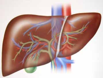 Negative outpatient liver workup Wilson s Disease Neg Ceruloplasmin Hemochromatosis Normal iron studies Alpha-1-Anti-trypsin
