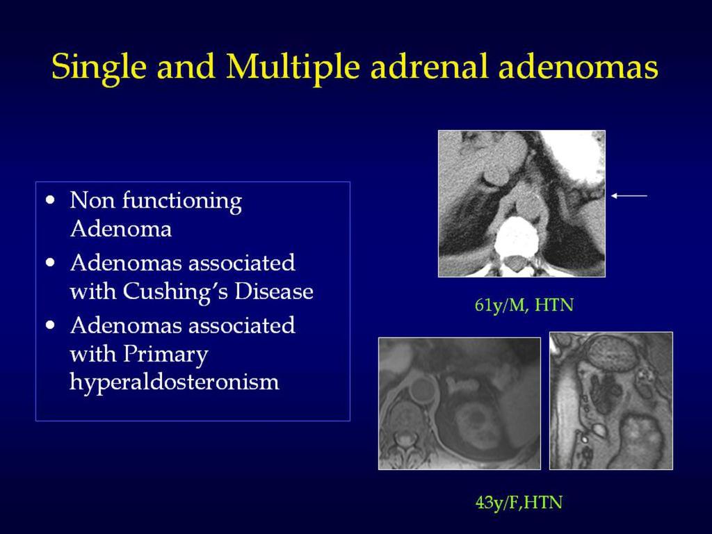 Fig. 8: Adrenal