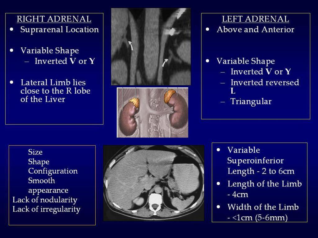 5.Adrenal Cysts developmental, post traumatic 6. Tuberculosis 7. Histoplasmosis 8. Adenoma single and multiple 9.