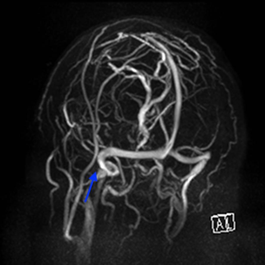 FIGURE 8: Magnetic resonance venography of the dural venous sinuses.