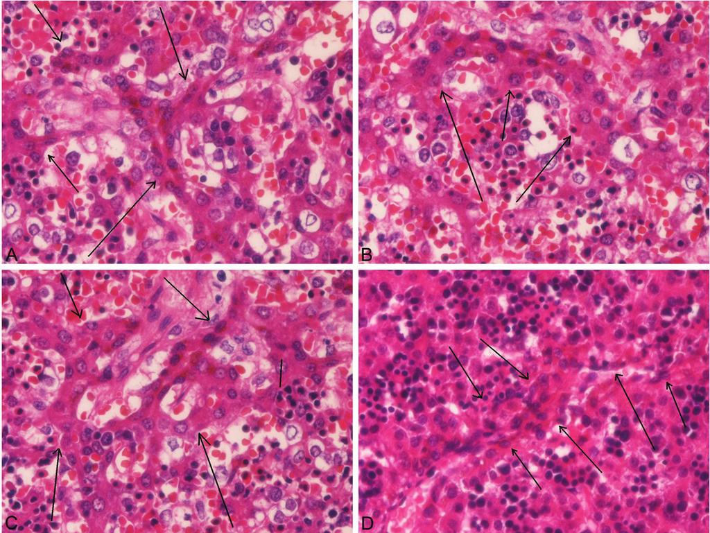 Figure 1. Histological features of intraparenchymal ductal plate within the hepatoblasts. Four examples are shown (arrows; A-D).