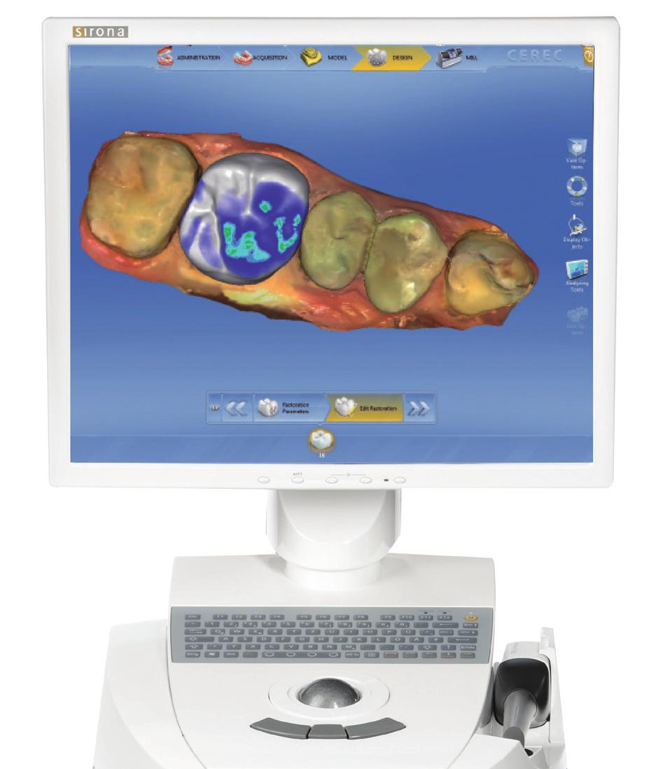 CEREC Omnicam Save your patients from the discomfort of a conventional impression tray. Take digital impressions using the CEREC Omnicam, our small color camera.