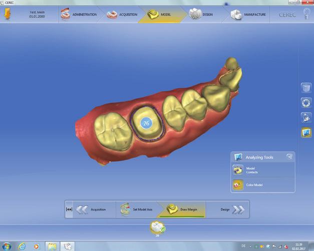 CEREC Software After analyzing the complete scan, the CEREC software generates outstanding restoration proposals.
