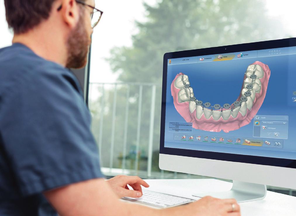 Practitioners focusing on orthodontics can utilize the advanced tools such as the integrated model analysis system.