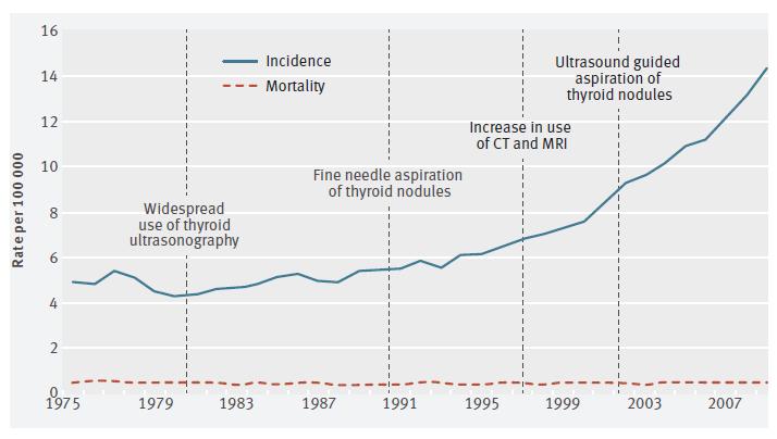 Incidence and mortality from thyroid cancer in the US, 1975-2009 and advent of new technologies, Brito, BMJ,