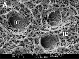 Fig 1a SEM micrograph of human dentin. DT = dentin tubules; Fig 1b SEM micrograph of bovine dentin.