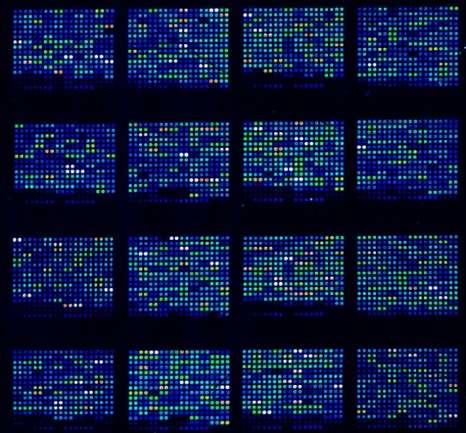 Multiple tests: DNA micro arrays The aim of DNA micro array experiments is to detect differential gene