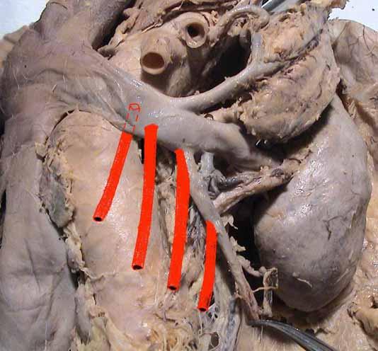gonadal vein Lumbar and gonadal vein