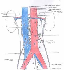 PARAORTIC LYMPH NODE 400-450 are the lymph nodes of a normal adult body >250 of them are located in the abdomen and pelvis About 81 lymph nodes are distributed between: the pelvis (50) the aortic
