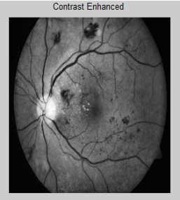 a) Input image b) Optic disc segmented image The next step is the blood vessel segmentation.