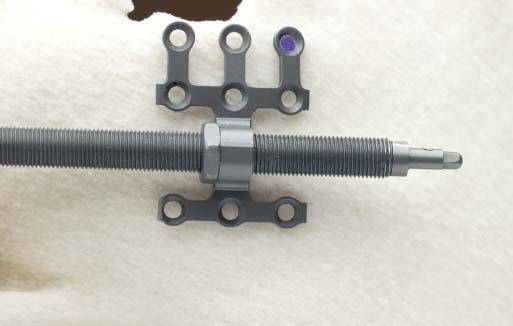 Device Placement 3 Mark the distractor location Instruments 311.005 Handle, with hex coupling, small 313.254 1.5 mm/ 2.