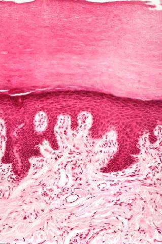The type of epithelium found in trachea is pseudostratified columnar epithelium with goblet cells.