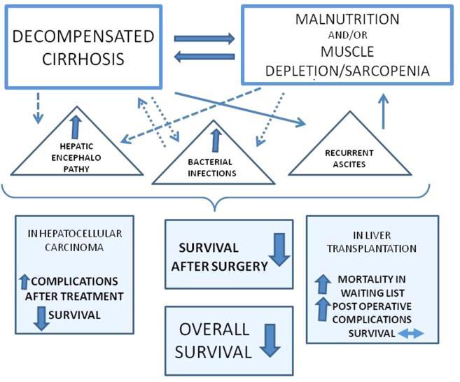 Complex relationship between malnutrition, cirrhosis-related