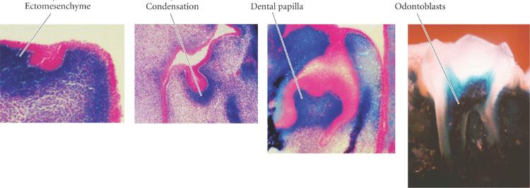 dental development ectodermal cells neural crest cells http://8e.devbio.com/article.