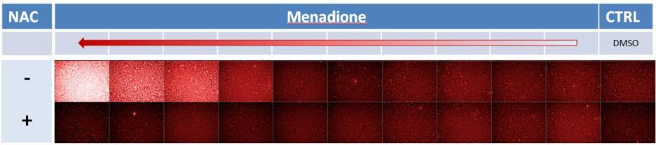 Factor) 1,99 1,42 1 NAC protecting factor = 57,7% 100 µm Menadione alone or with 50