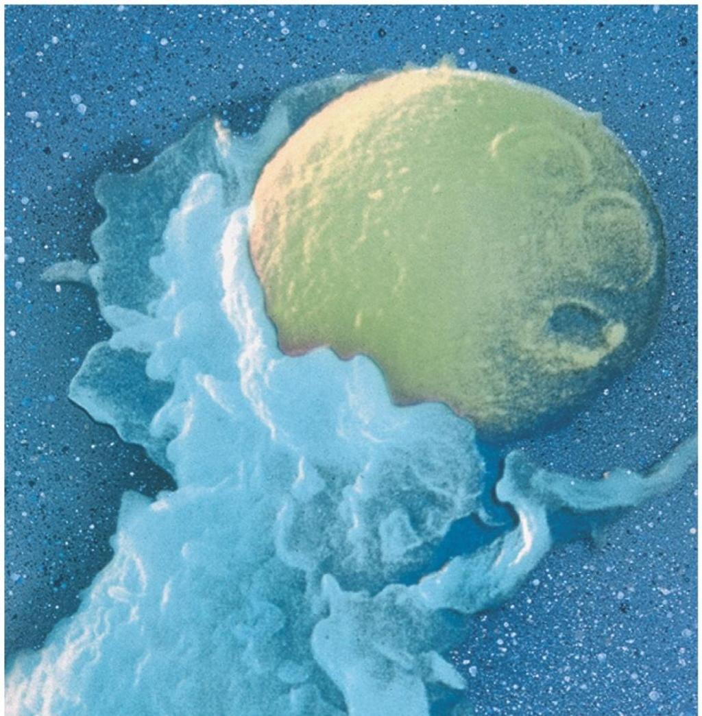 Capture of a yeast cell (yellow) by membrane