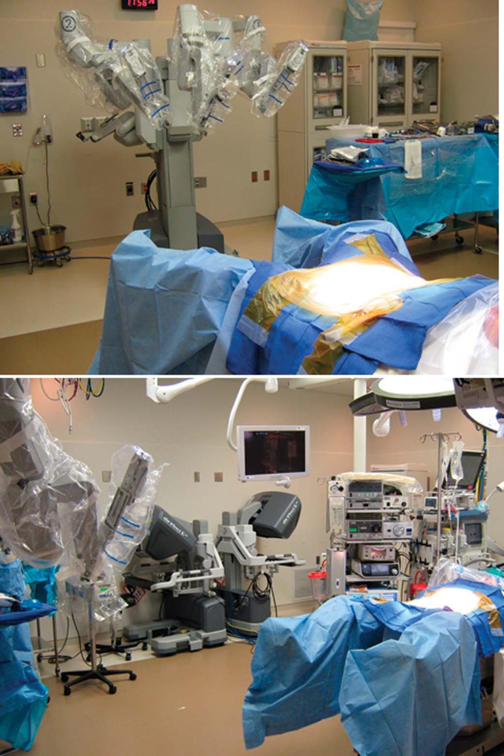 Holder-Murray et al Inflamm Bowel Dis Volume 21, Number 6, June 2015 FIGURE 6. Robotic assisted laparoscopic surgery. Top panel: robot awaiting docking in lithotomy position.