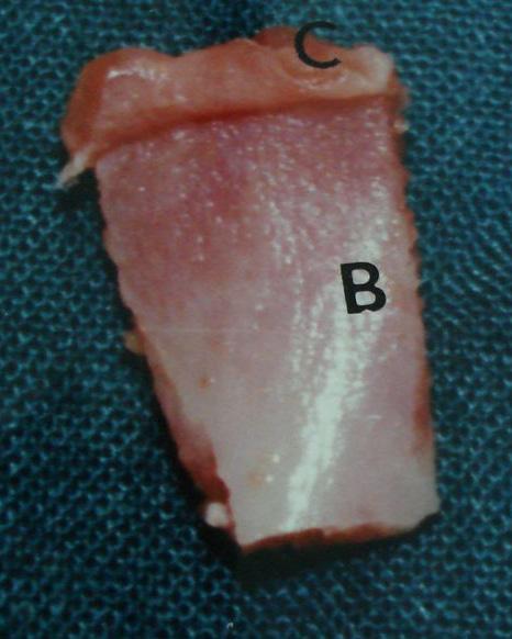 Results All animals showed neither restriction of mouth opening nor difficulty in mastication; by the end of the experiment after 3 months, the rabbit gained approximately 0.