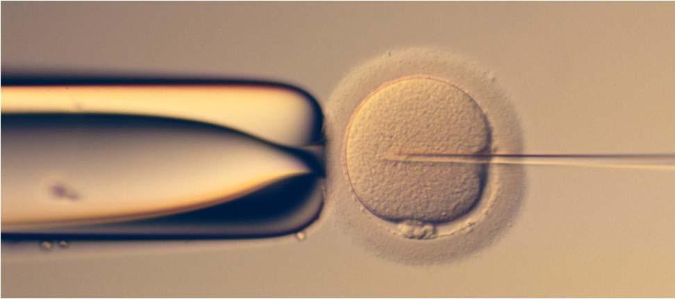 INSEMINATION Once the sperm has been prepared and the eggs have been collected, insemination is performed: IVF standard insemination ICSI IVF: