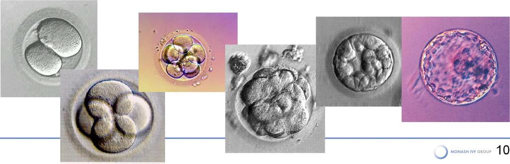 EMBRYO CULTURE Embryos are grown in the lab until the morula/blastocyst stage and
