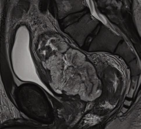 Clinical Oncological Imaging Case 5 65-year-old male patient with