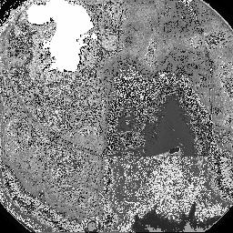 Cells Implantation in Human