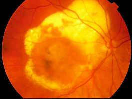 Ophthalmology Director Eye Institute Stem cell