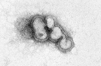 Influenza virus (From RDolin, Am FamPhys 14:74, 1976.
