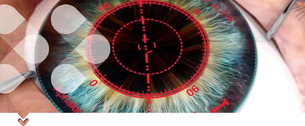 P=(n 1)/r IOL power calculation relies on three measurements: axial length, corneal power and anterior chamber depth Corneal power calculations rely on determining the radius of curvature of the